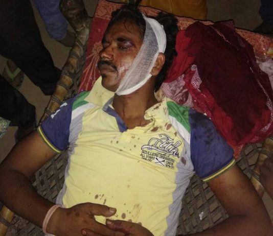 अब बलिया में दलितों पर हमला, 6 बुरी तरह घायल, 3 की हालत गंभीर