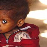 झारखंड में कुपोषित बच्चों की संख्या में इज़ाफ़ा, क्या है कारण?