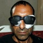 Kashmiri Journalist sells his dream news agency to fund treatment for pellet injuries