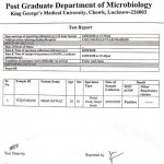 कोरोना के चलते यूपी में ‘कंप्लीट लॉकडाऊन’ शामली में एक ‘पॉज़िटिव केस’, बिजनौर में बुख़ार के मरीज़ ने की खुदकुशी