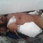 “My brother’s wounds are screaming of monstrosity of attack,” family of lynching survivor Akhlaq Salmani losing hope for justice