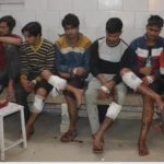 यूपी की मुठभेड़ : 7 पशु तस्करों के पैर पर एक ही जगह लगी गोली